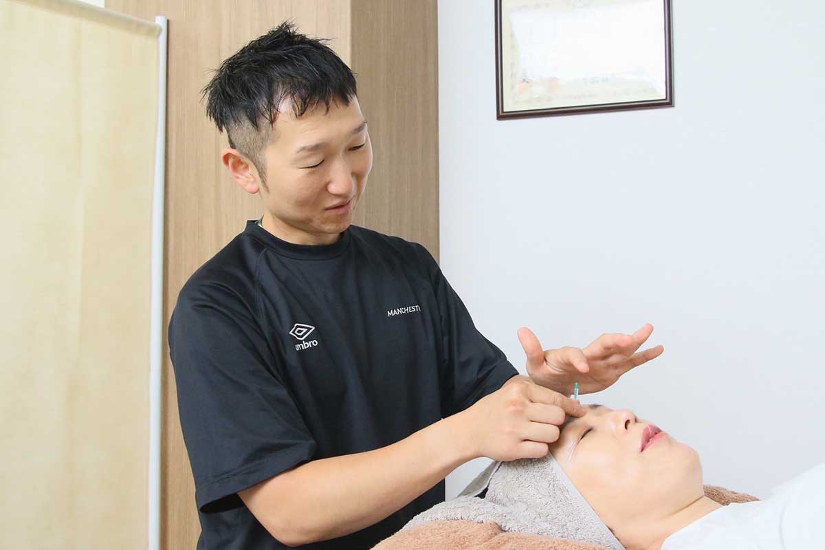 美容鍼の実際のイメージ